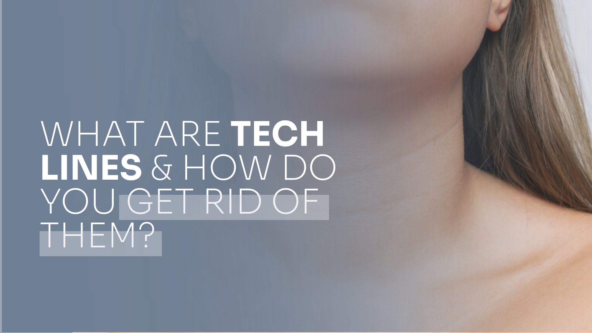 What Are Tech Neck Lines & How Do You Get Rid Of Them?
