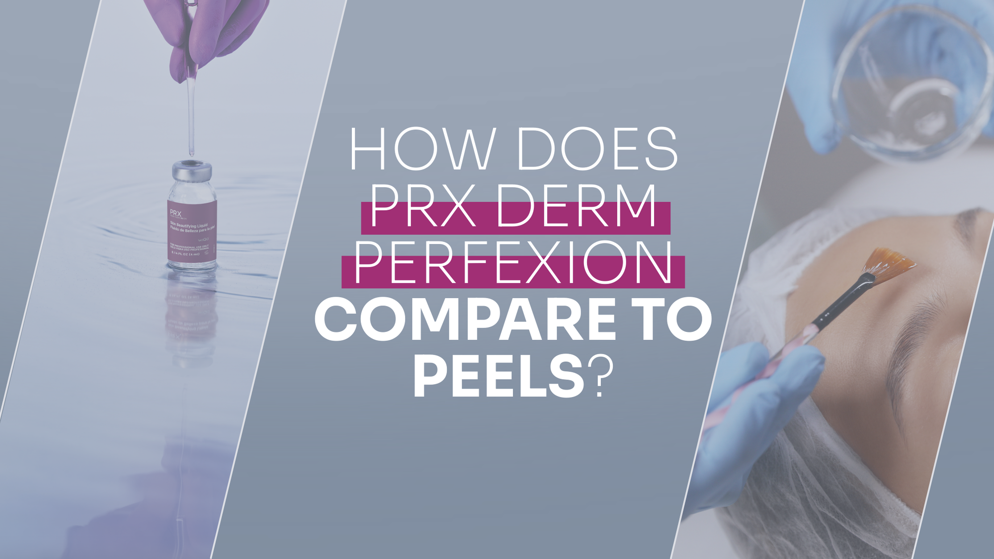 How Does PRX Derm Perfexion Compare To Peels