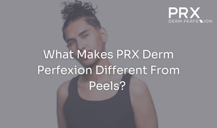 What Makes PRX Derm Perfexion Different From Peels?