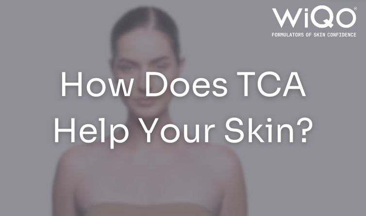 How Does TCA Help Your Skin?