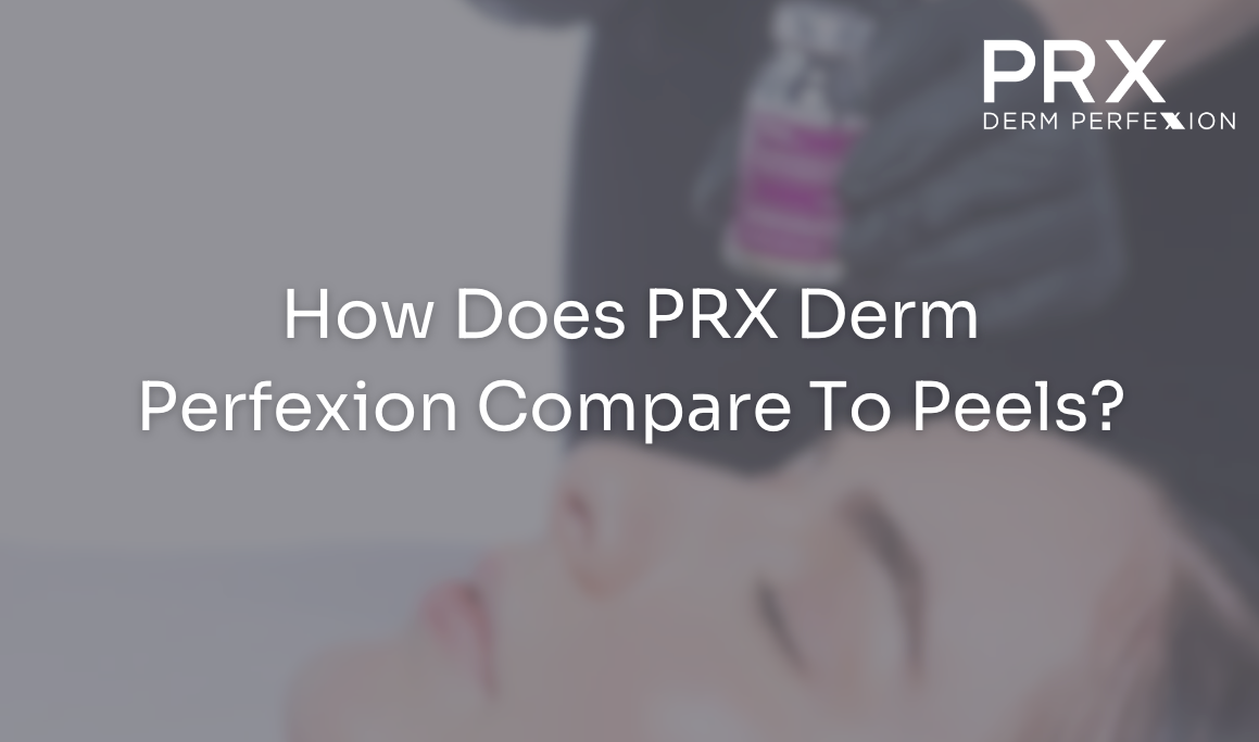 How Does PRX Derm Perfexion Compare To Peels