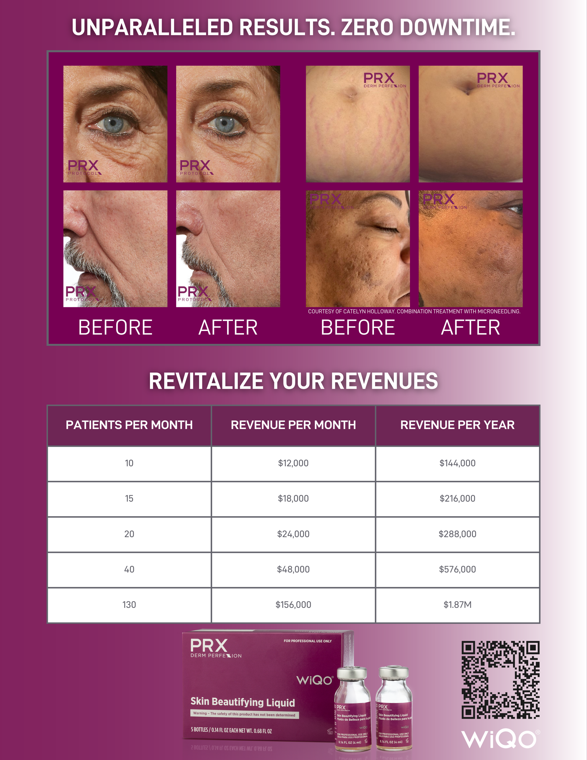 PRX Derm Perfexion Sales Flyers